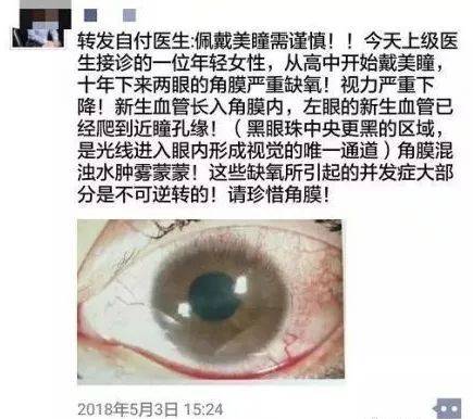 开云电竞:《狐踪谍影》即将上映 安琥带你玩转谁是内奸?(图2) 开云电竞